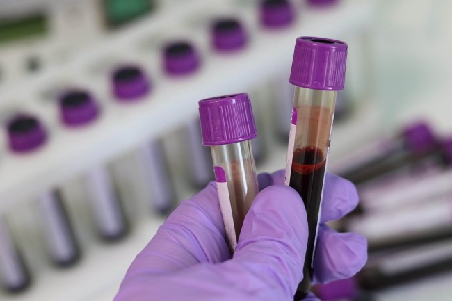 blood vials lab