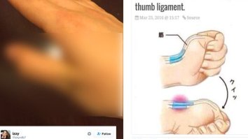 Idiots On Twitter Are Breaking Their Thumbs Over This Stupid Tweet About How To Break Your Thumb Ligament