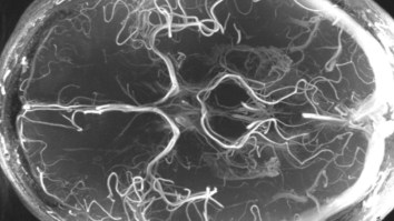 You, Me, And Everyone Will Be Obsolete By 2029, Replaced By Smart And Sexy Super Humans