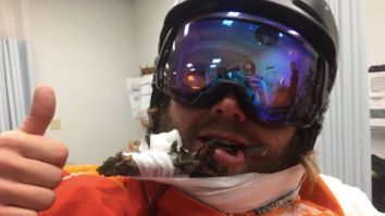 Bro Ski Instructor Has The Chillest Response After Getting Impaled In The Face By A Tree Branch