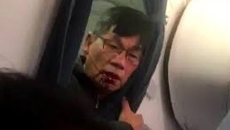 Doctor Forcibly Removed From United Flight Suffered Concussion, Broken Nose And Lost Teeth