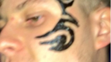 Dude Gets ‘Temporary’ Mike Tyson Henna Face Tattoo That Burns A Permanent Scar…On His Face