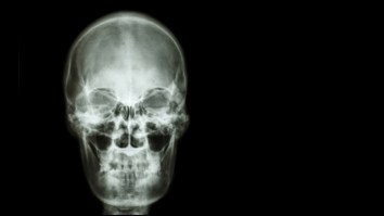 The World’s First Human Head Transplant Was Just Completed On A Corpse, Which Is Not At All Horrifying