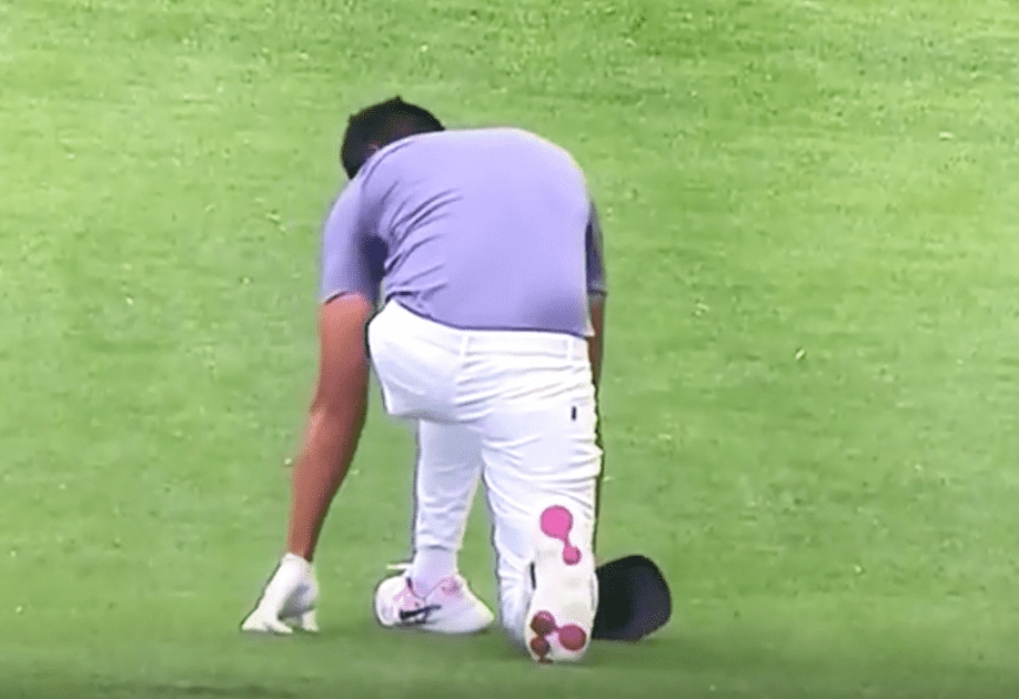 Tony Finau Posts Pictures Of Gruesome Ankle Injury He Played With