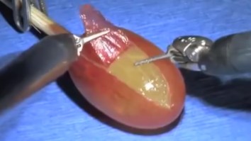 Humans Created Robot Doctors And They Did Surgery On A Grape, The Internet Made Hilarious Memes