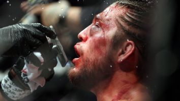 Fans Are Shocked That Brian Ortega Is Nearly 100% Healed A Week After Sustaining Scary Injuries At UFC 231