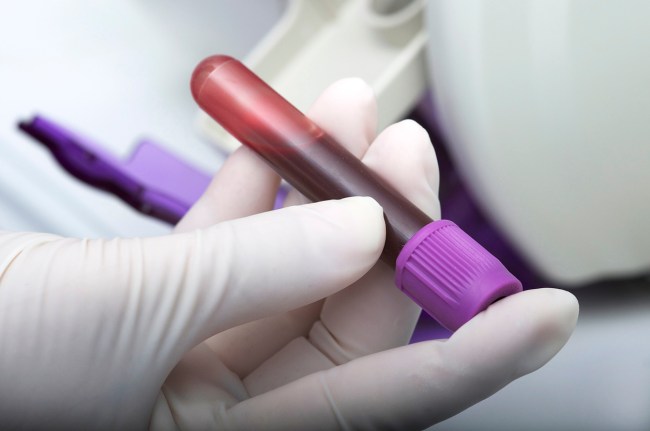 cancer blood test high accuracy