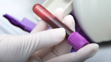 A Revolutionary New Blood Test Can Detect More Than 20 Types Of Cancers With Almost 100% Accuracy