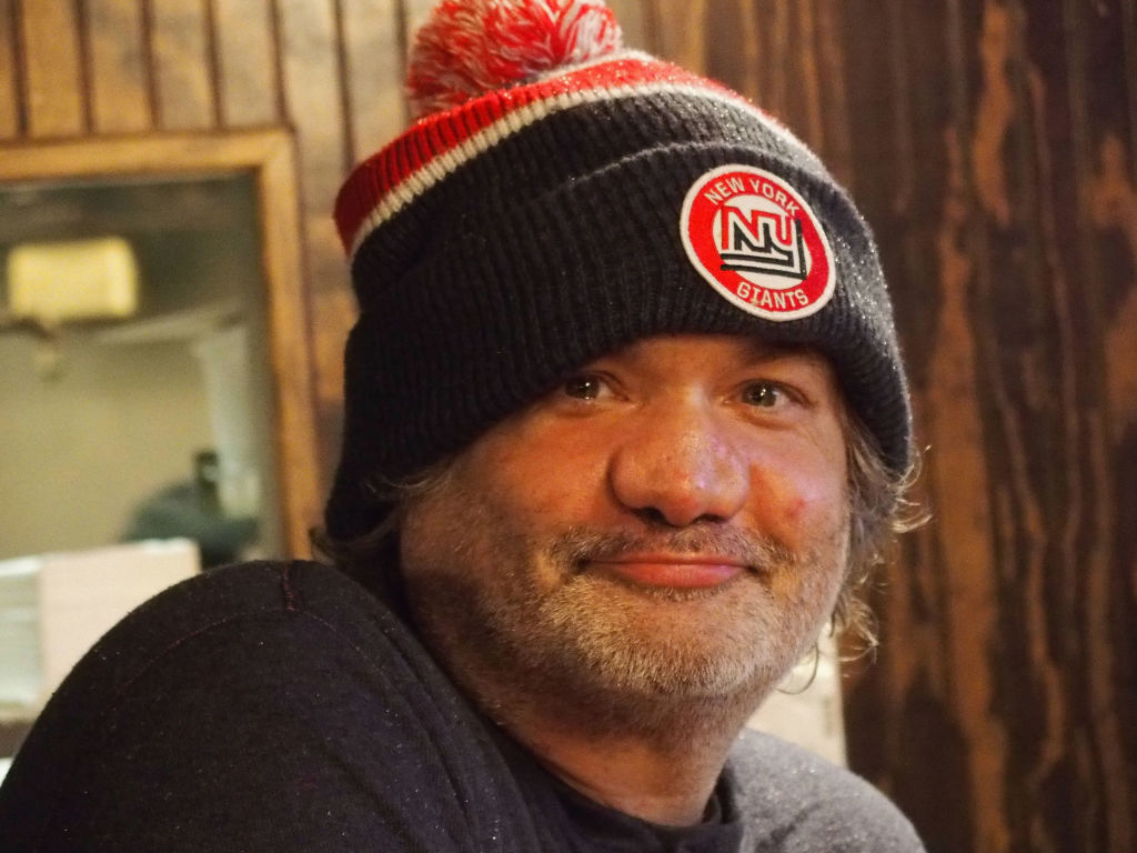 Artie Lange Is Very Close To Getting His Deformed Nose Fixed By Dr Paul Nassif On Botched