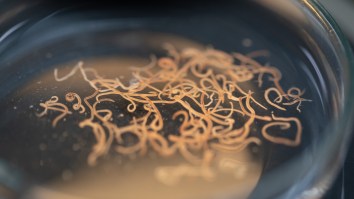 Man Who Suffered Frequent Seizures And Blackouts Has Tapeworm Removed From Brain After 15 Years