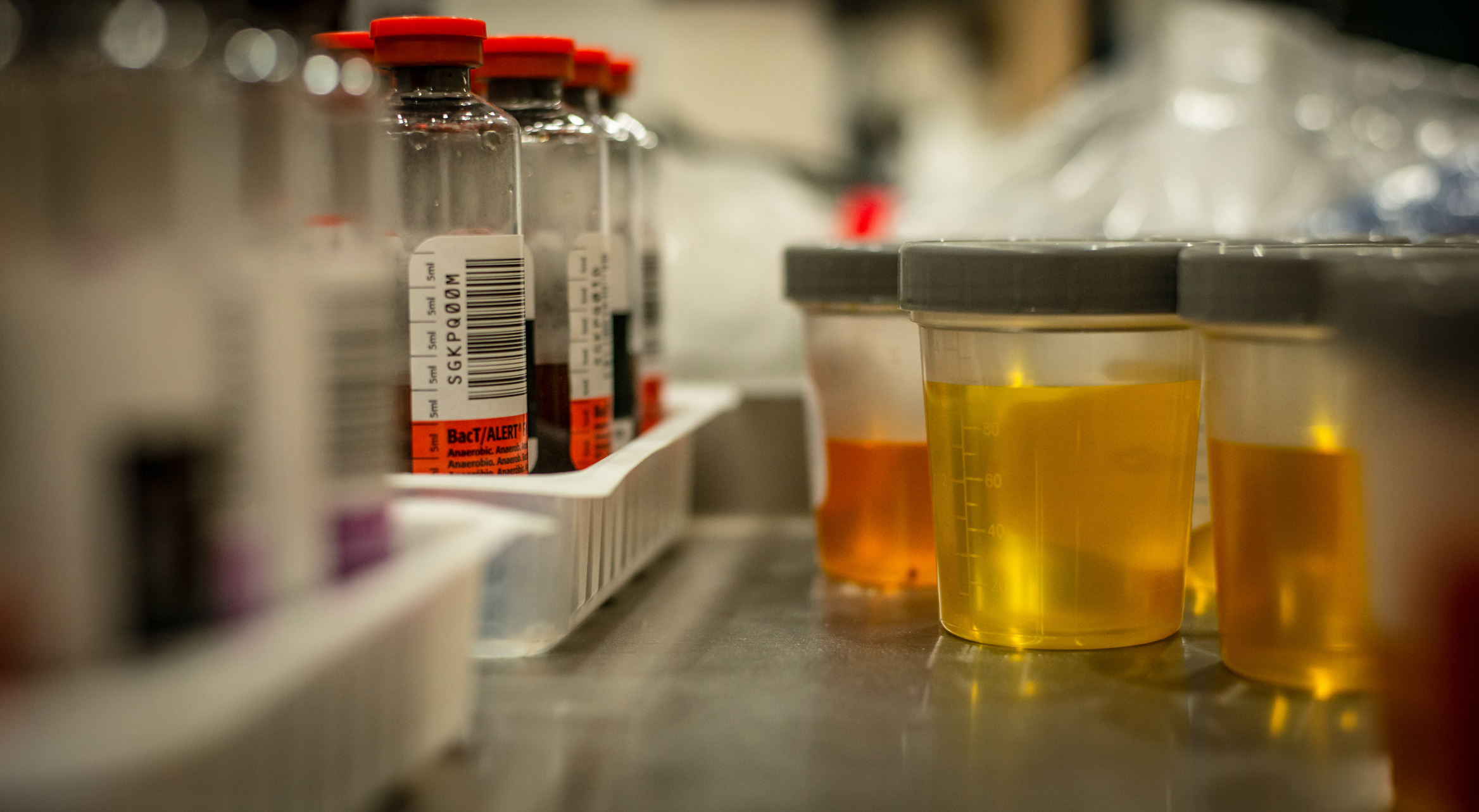 Can You Pass A Drug Test With Animal Urine? BroBible