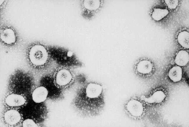 The latest news on Coronavirus is that there are now 362 people dead and the update is that there are 11 cases in the US.