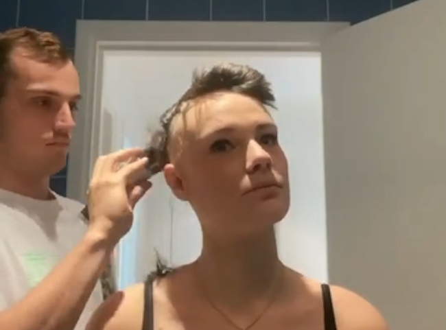 boyfriend head shave alopecia