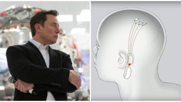 Elon Musk’s Brain-Implant Company Plans To Unveil Working Device This Week