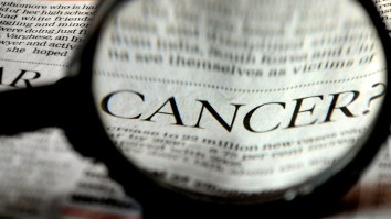 Certain Cancers Are On The Rise Among Young Americans But The Exact Reason Why Is Unclear