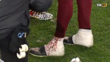 Washington QB Alex Smith Was Gushing Blood From His Leg After Getting Accidentally Stepped On By Offensive Lineman