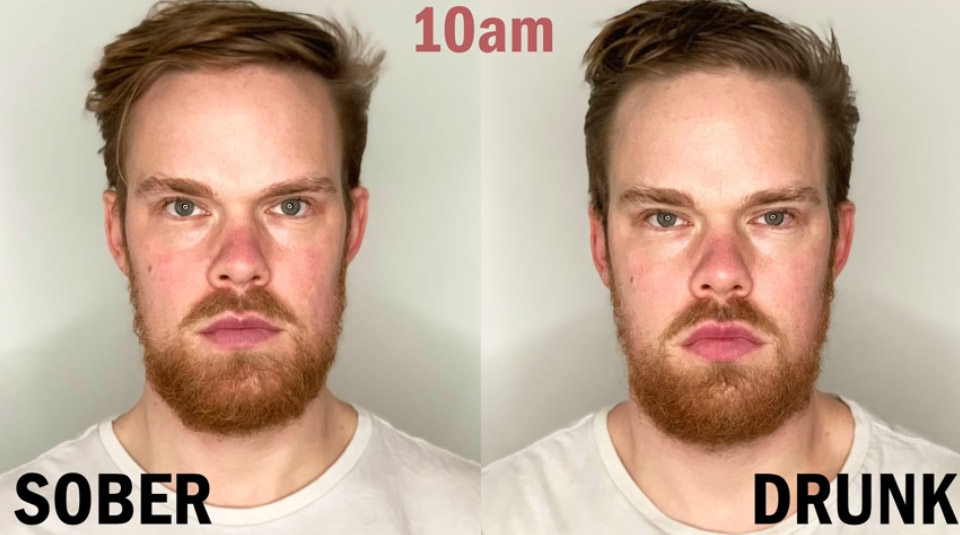Did You Know Getting Drunk Actually Changes The Way Your Face Looks
