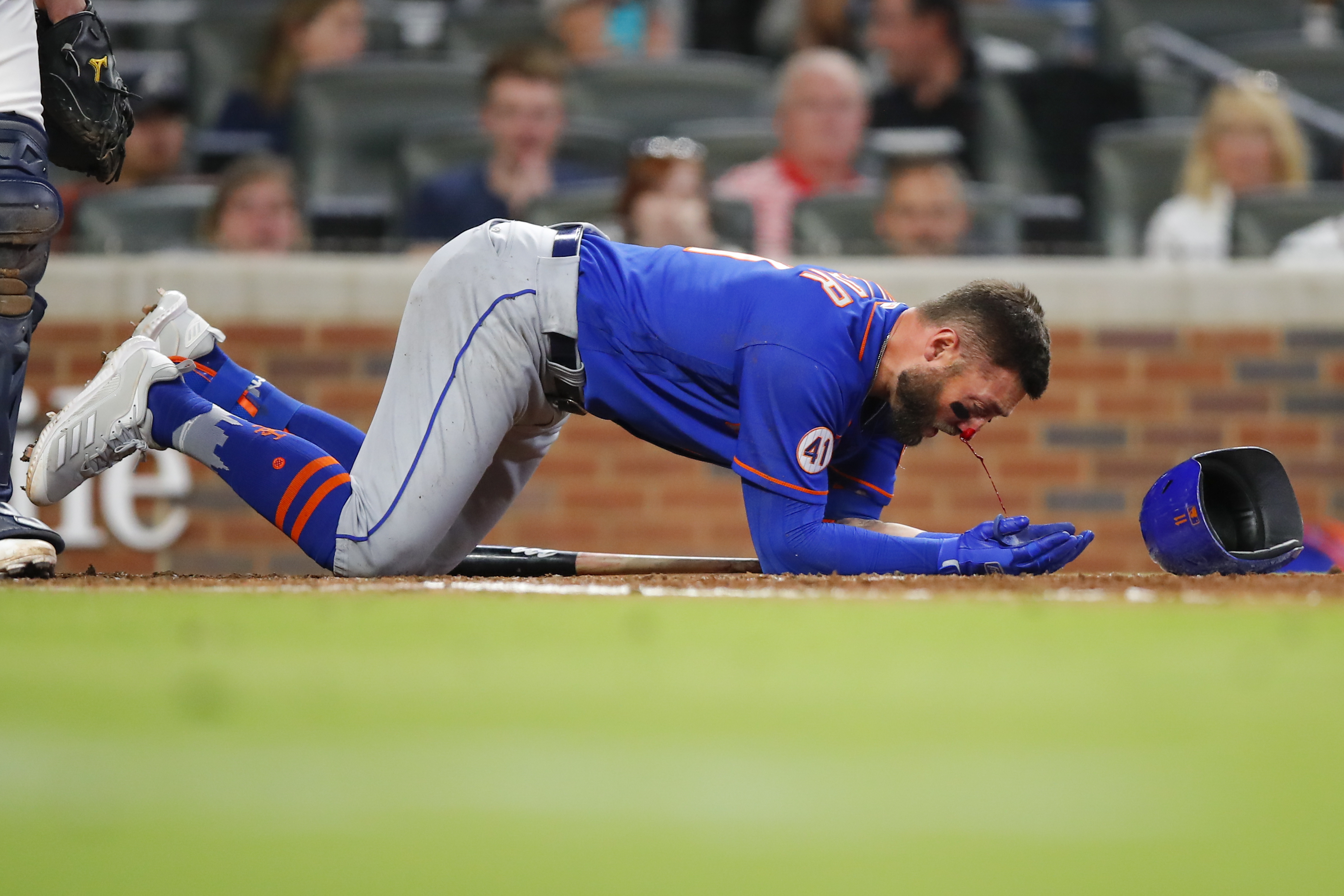 Mets OF Kevin Pillar hit in face by 95 mph fastball