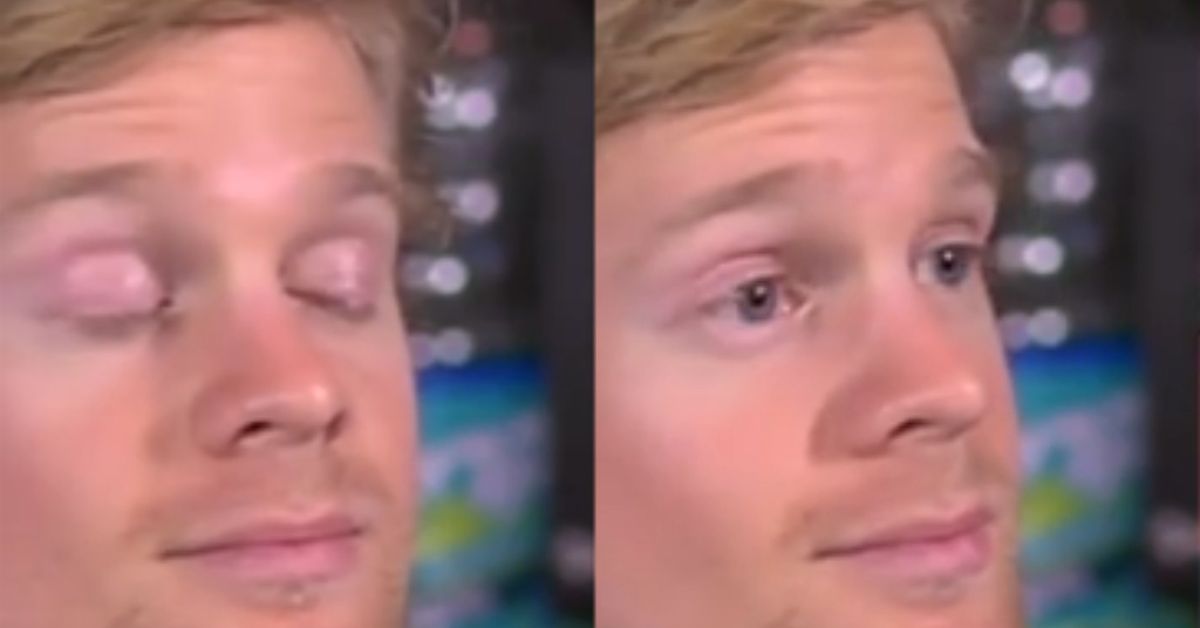 'Blinking White Guy' Drew Scanlon Uses His Meme Status To Raise Over