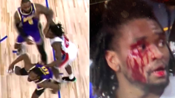 LeBron James Gets Ejected For Punching Pistons’ Isaiah Stewart In The Eye, Leaving Stewart A Bloody Mess