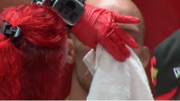 MMA Fighter Tries To Fight With Nasty-Looking Crooked/Broken Nose After Taking Knee To The Face