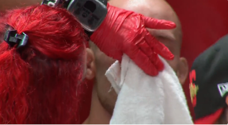 MMA Fighter Tries To Fight With Nasty-Looking Crooked/Broken Nose After Taking Knee To The Face