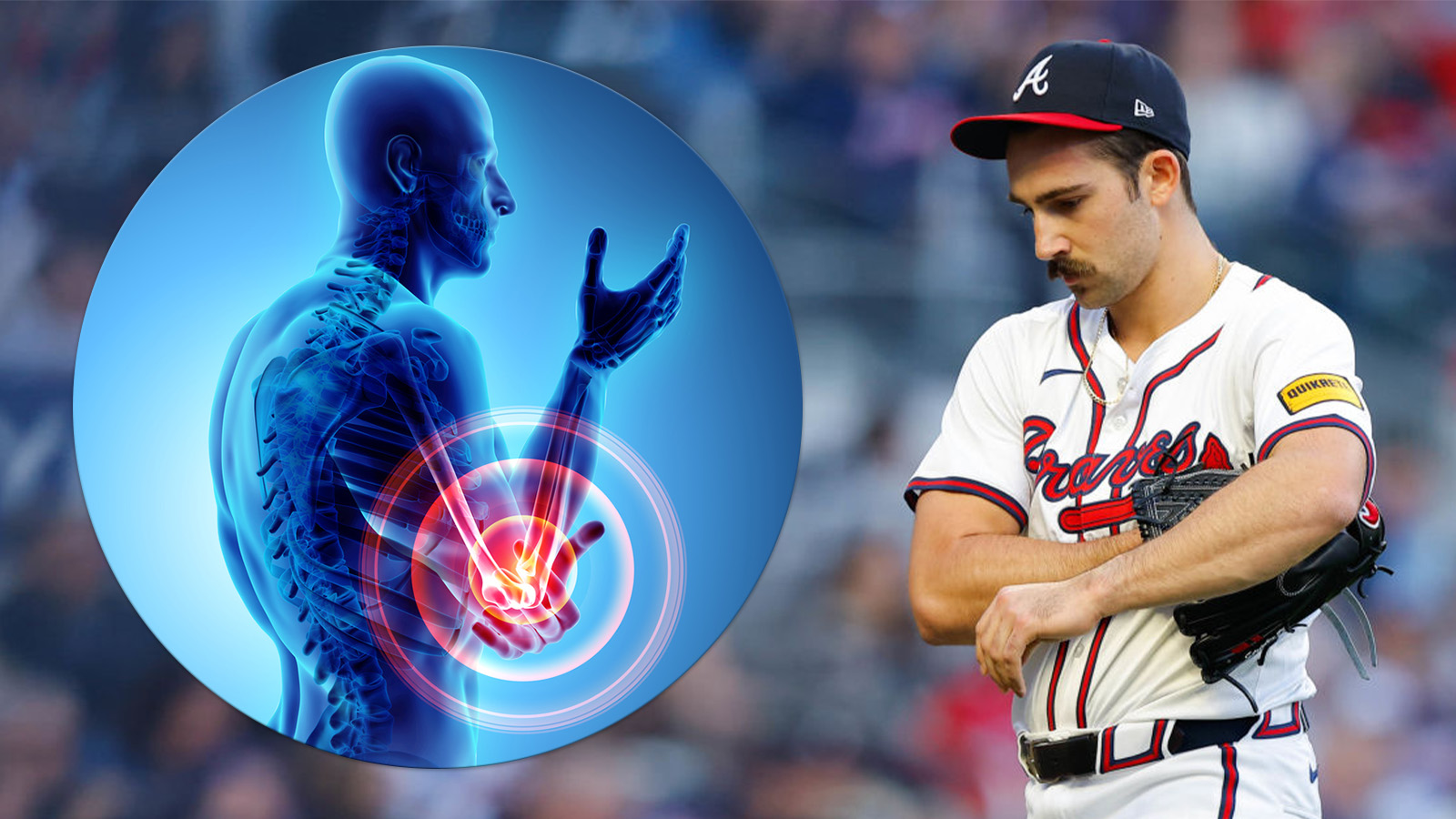 Trevor Bauer Could Be Blamed For MLB's Pitcher Injury Problem