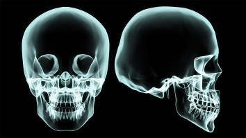 Controversial Neurosurgeon Says He’s Ready To Perform A Human Head Transplant