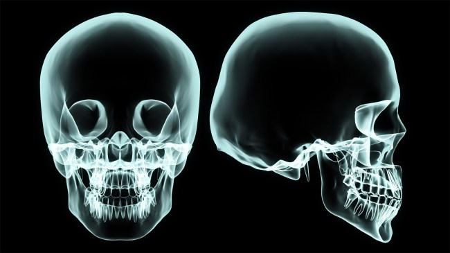 X-ray human head skull