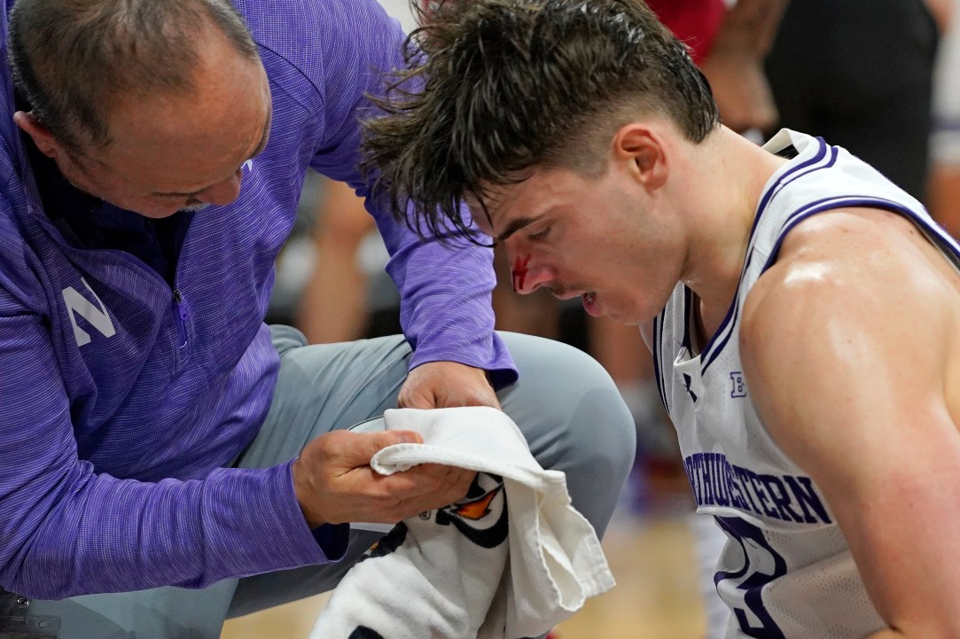 Brooks Barnhizer Nose