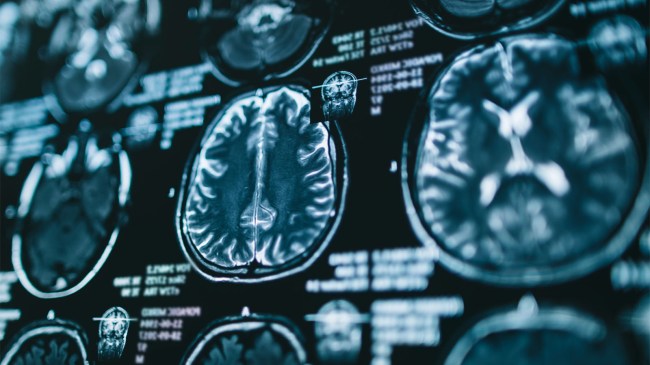 Magnetic-resonance-scan-of-the-brain