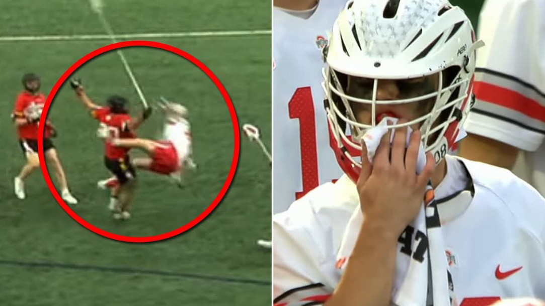 Gannon Matthews Ohio State Lacrosse Teeth