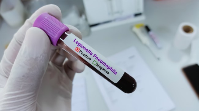 Legionnaires-disease-Legionella-Pneumophila