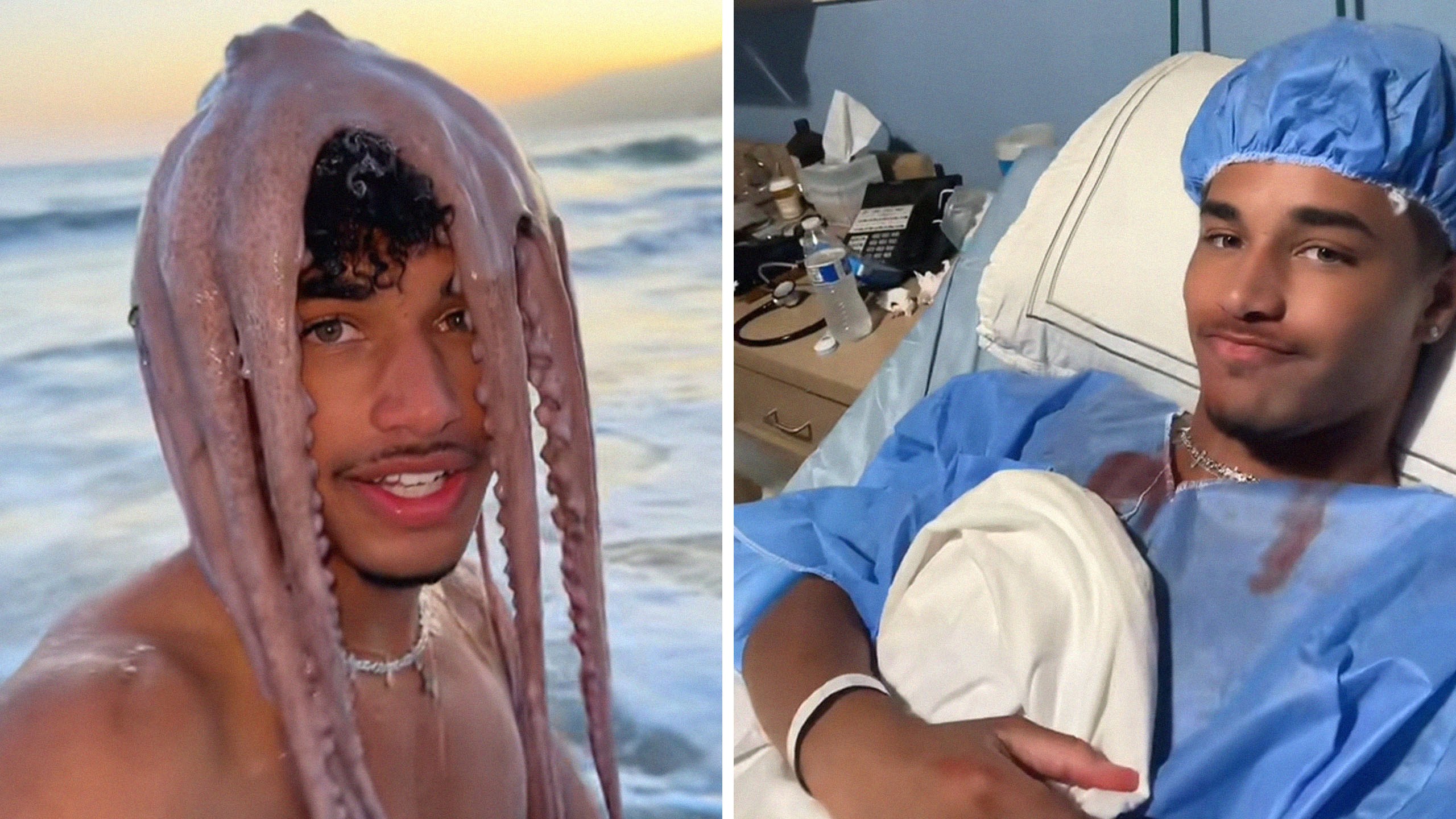 TikToker Puts Octopus On His Head. Why'd It Make Him Sick?