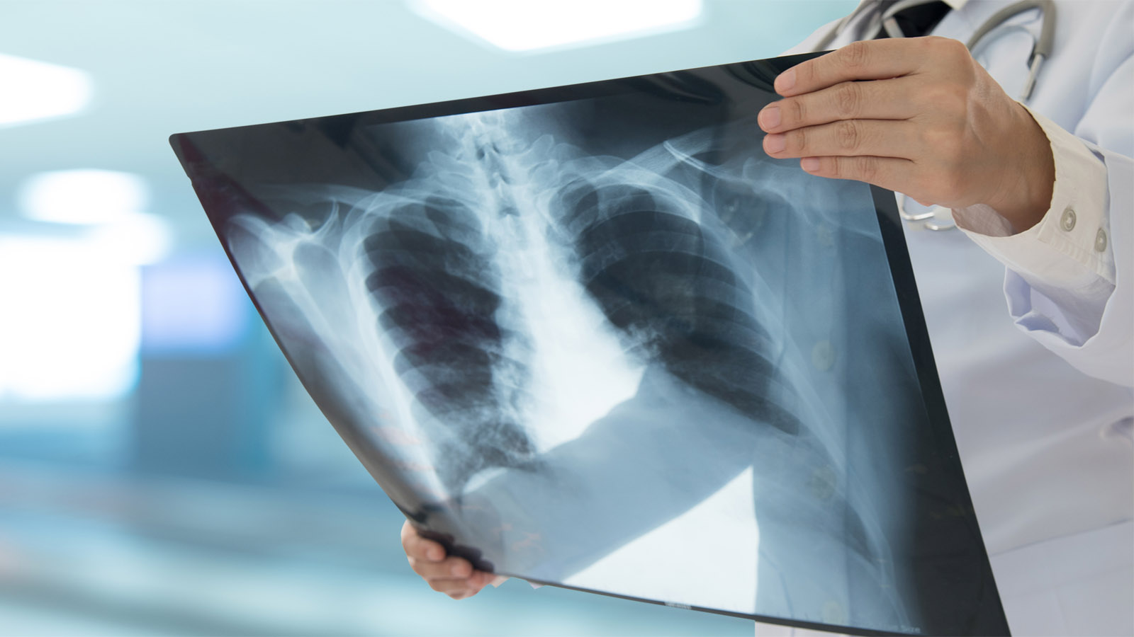 Maine Concerned About New, Active Tuberculosis Cases