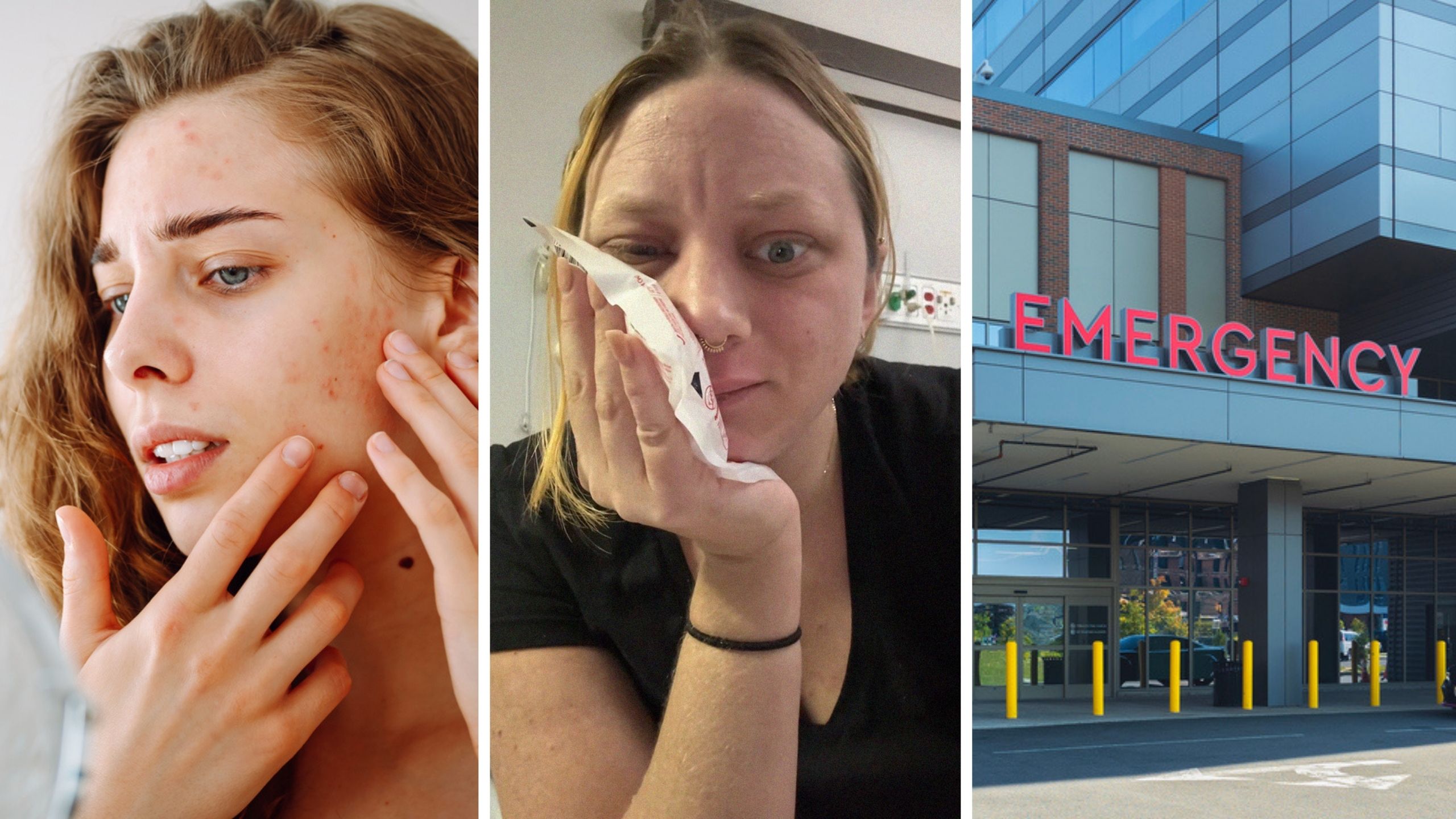 woman with acne (l) woman shares emergency story (c) emergency room (r)