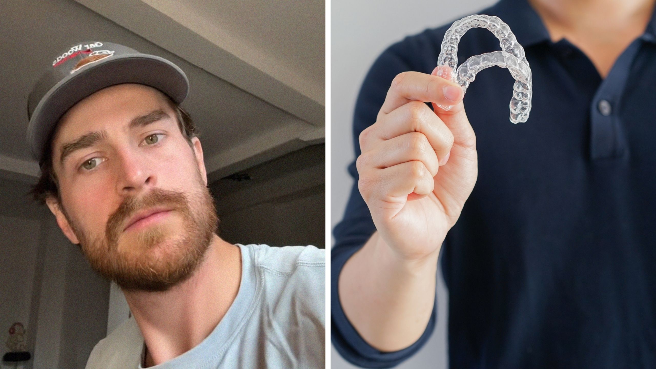 man shares invisalign issue (l) hand holding retainers (r)