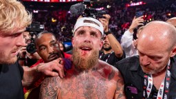 Jake Paul Had Surgery To Fix ‘Double’ Broken Jaw From Anthony Joshua Punch, Likely Out 6 Months From Fighting