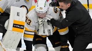 Charlie McAvoy after jaw injury