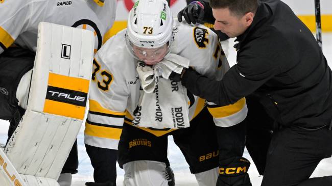 Charlie McAvoy after jaw injury