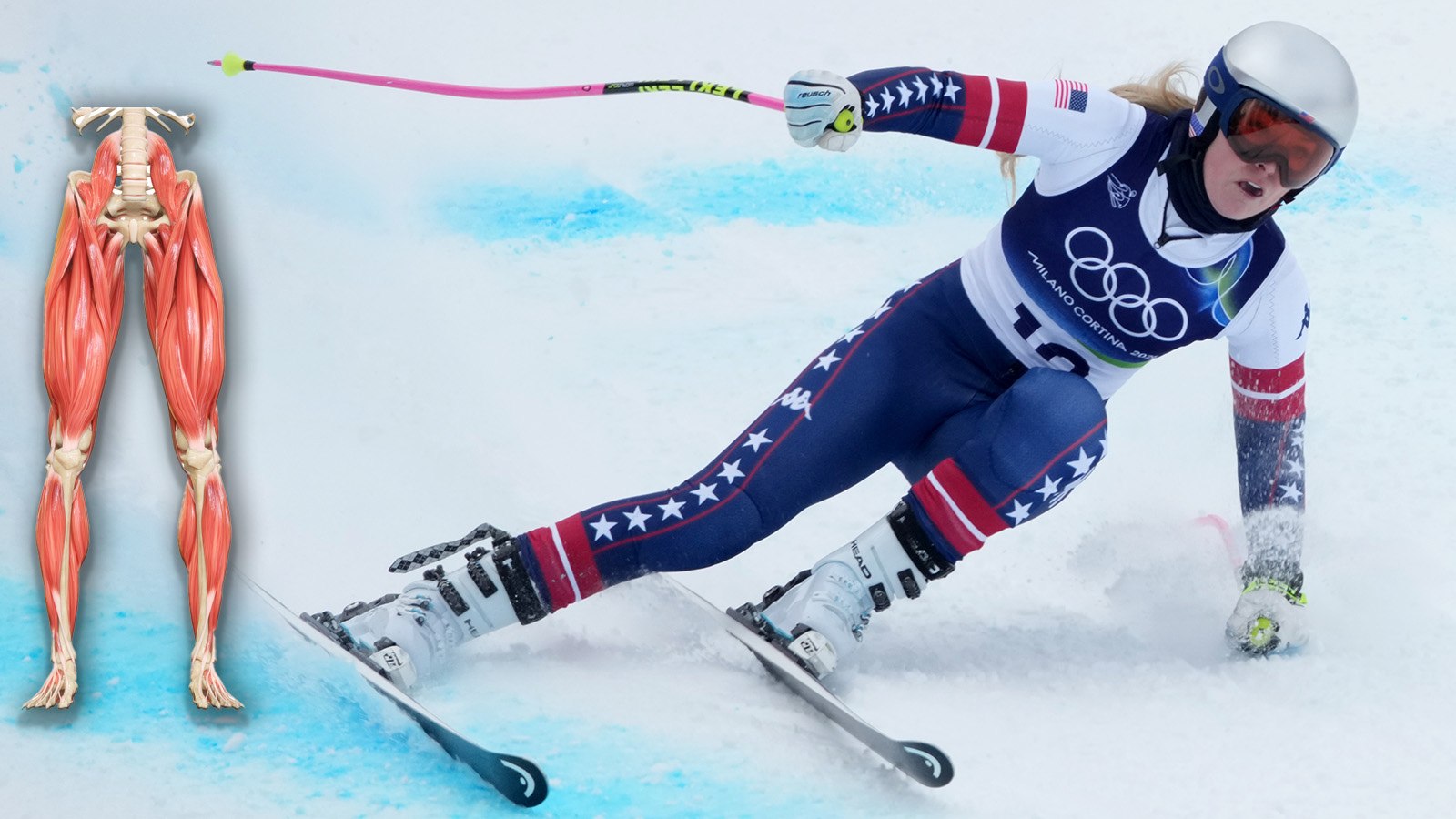 Lindsey Vonn Reveals Extreme Muscle Atrophy After Almost Losing Her Leg In Crash At Olympics