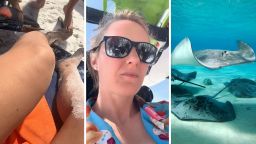 Woman Reminds Viewers Of The ‘Stingray Shuffle’ After One Slices Her Achilles Tendon: ‘It Felt Like A Knife’