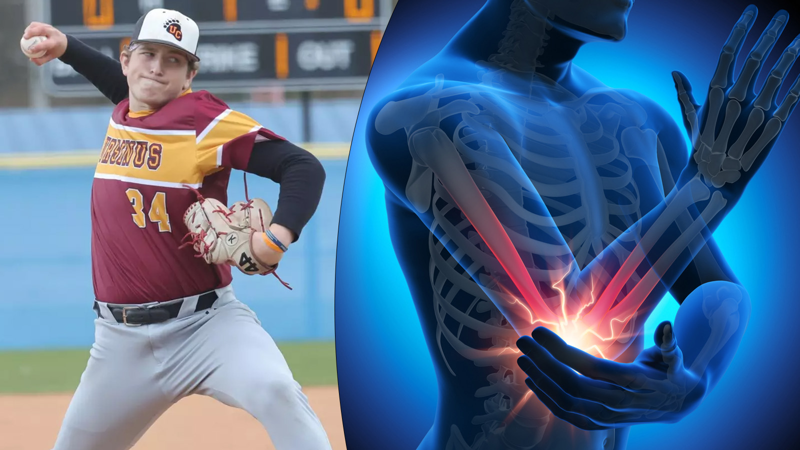 Pennsylvania Baseball Pitcher Who Threw 475 Pitches In Just 12 Days Does Not Need His Elbow