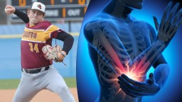 Pennsylvania Baseball Pitcher Who Threw 475 Pitches In Just 12 Days Does Not Need His Elbow
