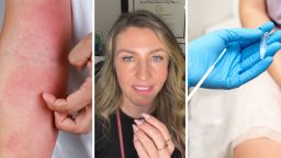 Dallas Doctor Warns There’s A New STD Spreading Across The U.S. Then She Reveals Why It’s So Unique: ‘It’s Not A Virus’