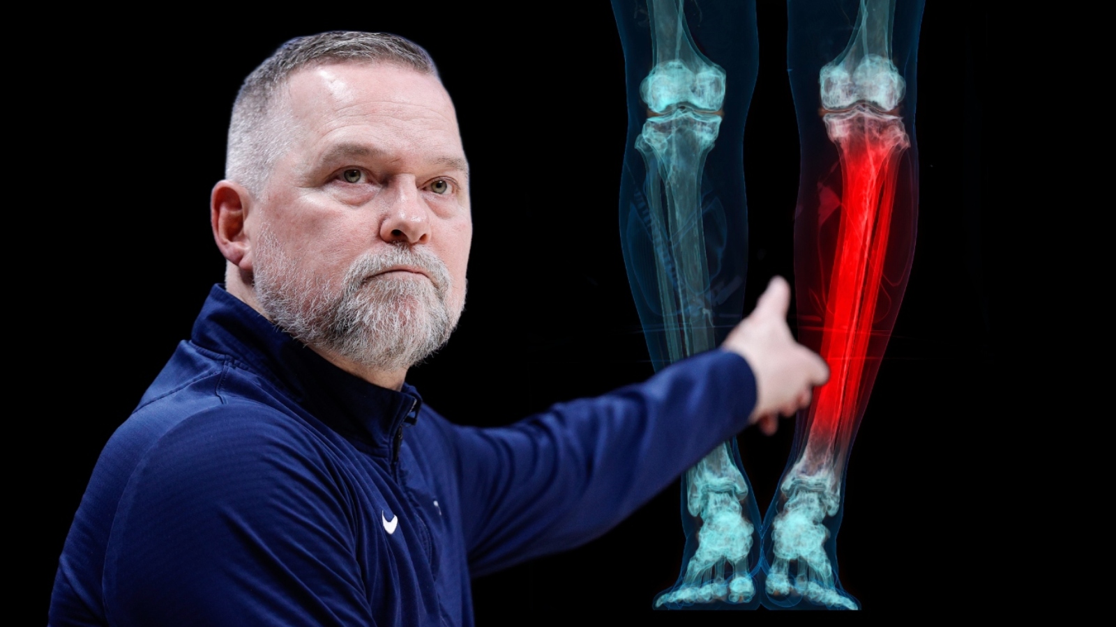 North Carolina Basketball Reportedly Dropped Dylan Mingo Because He’s Bow-Legged