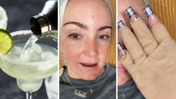 New York Woman Says A Margarita Gave Her 2nd-Degree Burns: ‘Margarita Burn Awareness’