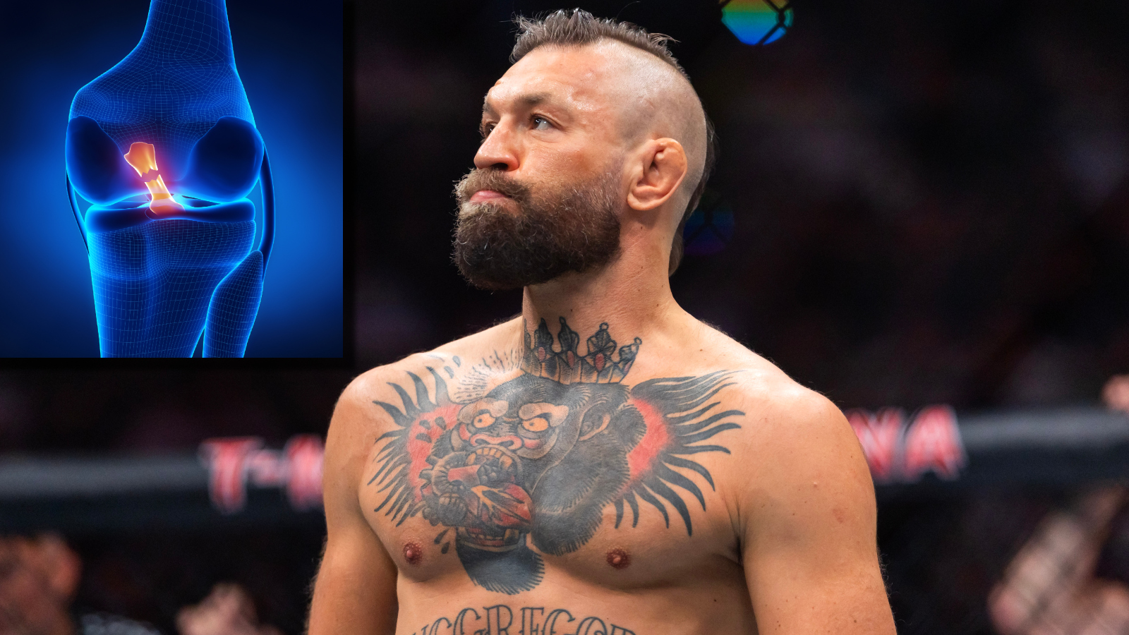 UFC fighter Conor McGregor next to an image of an ACL injury