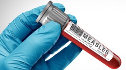 For The First Time In 35 Years, Two People, Both Unvaccinated, Have Died Due To Measles In Pennsylvania