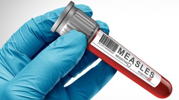 For The First Time In 35 Years, Two People, Both Unvaccinated, Have Died Due To Measles In Pennsylvania